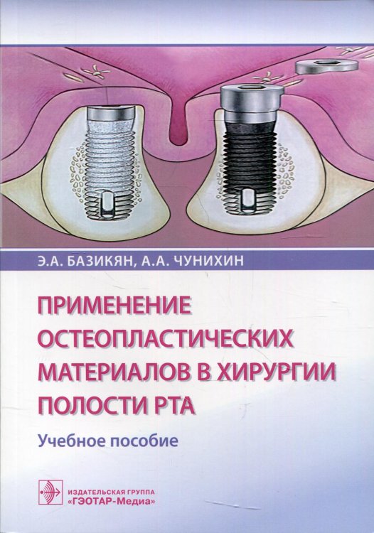 Применение остеопластических материалов в хирургии полости рта: Учебное пособие Применение остеопластических материалов в хирургии полости рта: Учебное пособие