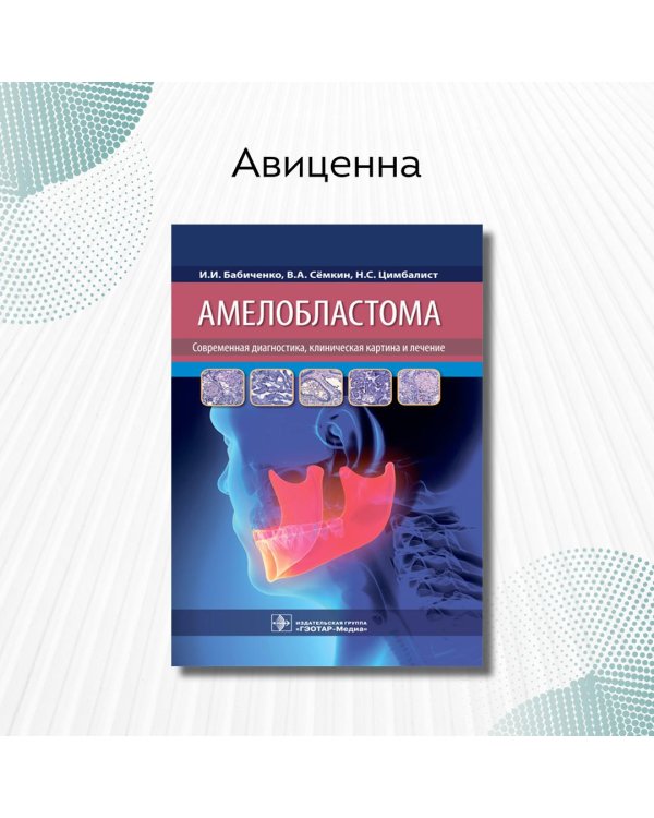 Амелобластома. Современная диагностика, клиническая картина и лечение