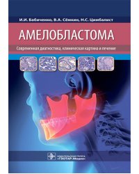 Амелобластома: современная диагностика, клиническая картина и лечение
