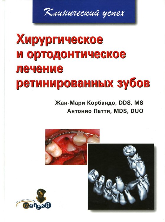 Клинический успех Хирургическое и ортодонтическое лечение ретинированных зубов
