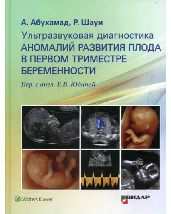 Ультразвуковая диагностика аномалий развития плода в первом триместре беременности