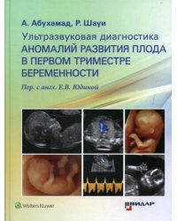 Ультразвуковая диагностика аномалий развития плода в первом триместре беременности