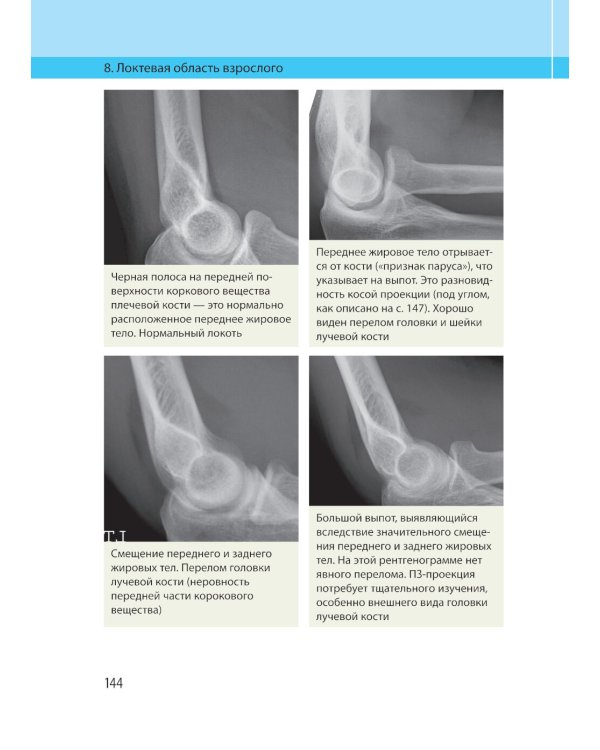 Неотложная радиология. Клиническое руководство