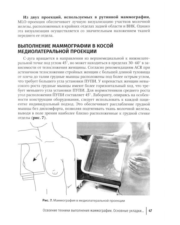 Технологический процесс рентгеновской маммографии