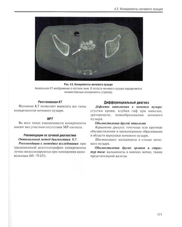 Визуализация заболеваний почек, мочеточников и мочевого пузыря: Учебное пособие