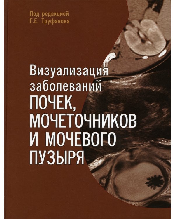 Визуализация заболеваний почек, мочеточников и мочевого пузыря: Учебное пособие