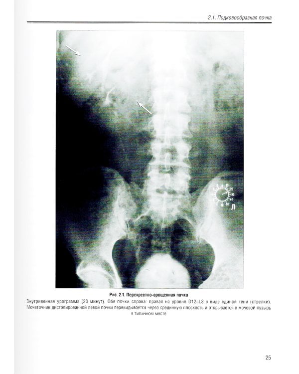 Визуализация заболеваний почек, мочеточников и мочевого пузыря: Учебное пособие