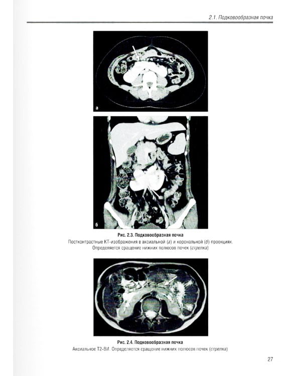 Визуализация заболеваний почек, мочеточников и мочевого пузыря: Учебное пособие