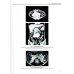 Визуализация заболеваний почек, мочеточников и мочевого пузыря: Учебное пособие