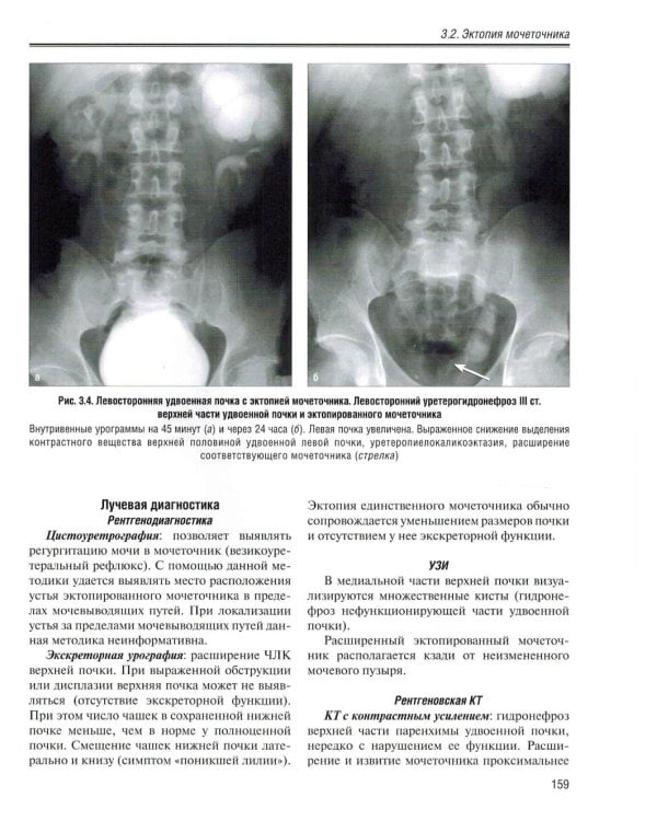 Визуализация заболеваний почек, мочеточников и мочевого пузыря: Учебное пособие