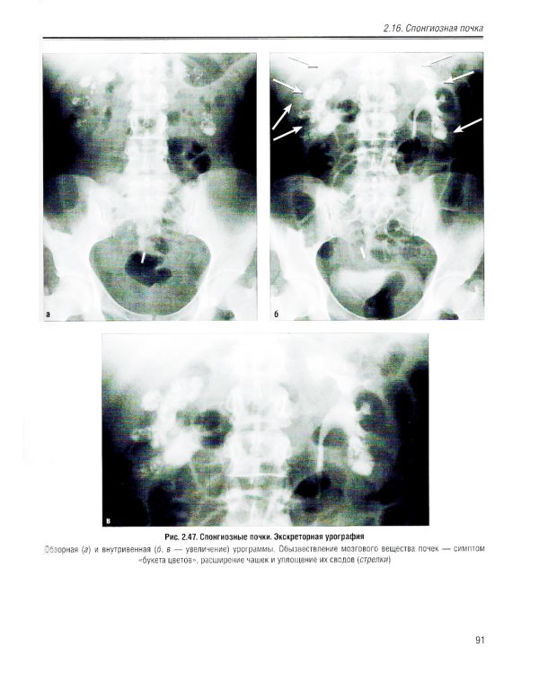 Визуализация заболеваний почек, мочеточников и мочевого пузыря: Учебное пособие