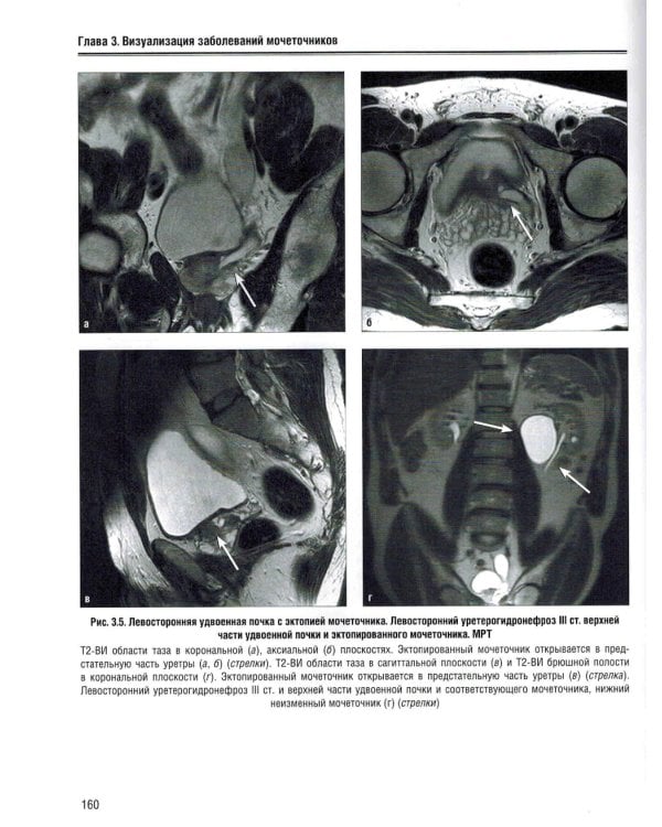 Визуализация заболеваний почек, мочеточников и мочевого пузыря: Учебное пособие