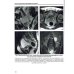 Визуализация заболеваний почек, мочеточников и мочевого пузыря: Учебное пособие