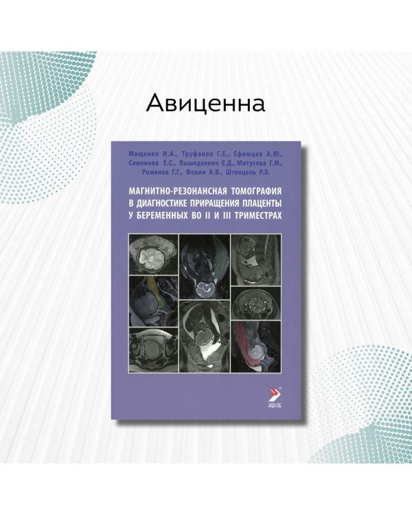 Магнитно-резонансная томография в диагностике приращения плаценты у беременных во II и III триместрах. Учебное пособие