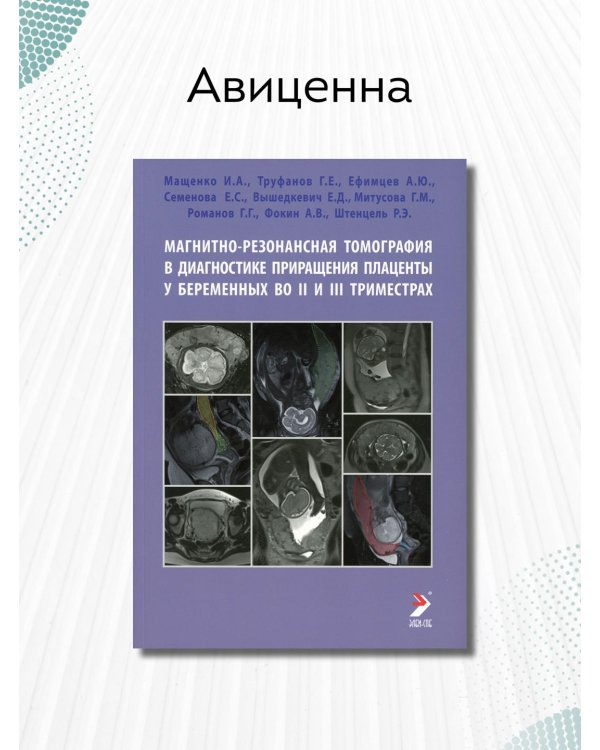 Магнитно-резонансная томография в диагностике приращения плаценты у беременных во II и III триместрах. Учебное пособие