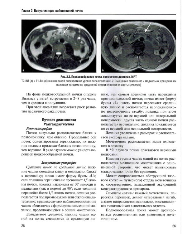 Визуализация заболеваний почек, мочеточников и мочевого пузыря: Учебное пособие