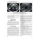 Визуализация заболеваний почек, мочеточников и мочевого пузыря: Учебное пособие