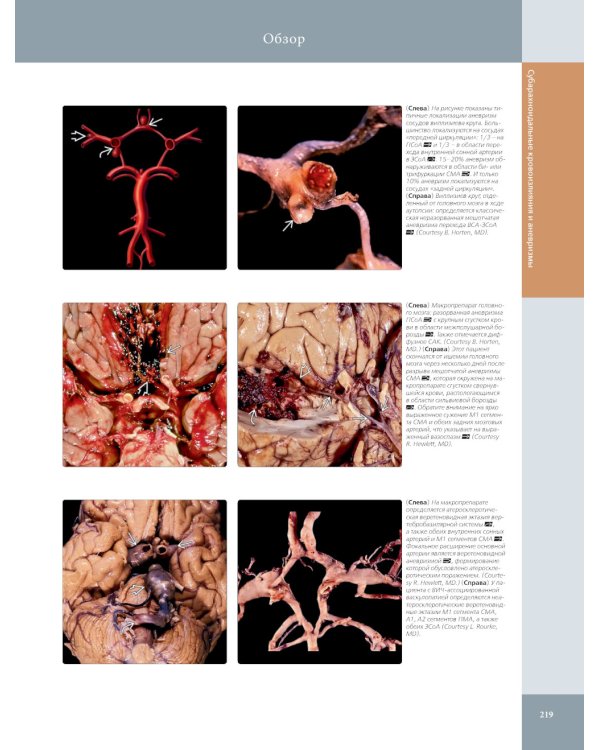 Лучевая диагностика. Головной мозг. В 3 т
