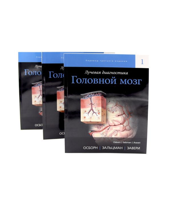 Лучевая диагностика. Головной мозг. В 3 т