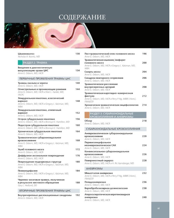 Лучевая диагностика. Головной мозг. В 3 т