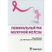 Люминальный рак молочной железы