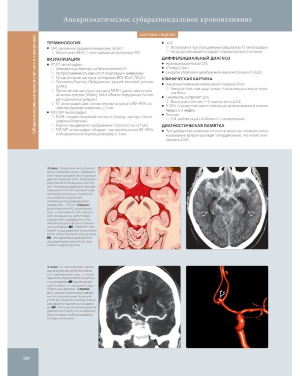 Лучевая диагностика. Головной мозг. В 3 т