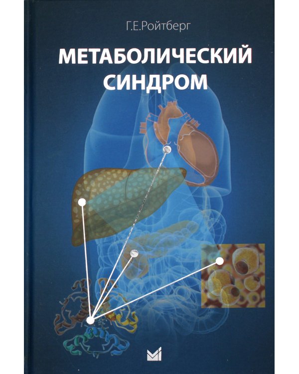 Метаболический синдром