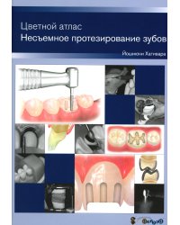 Несъемное протезирование зубов. Цветной атлас