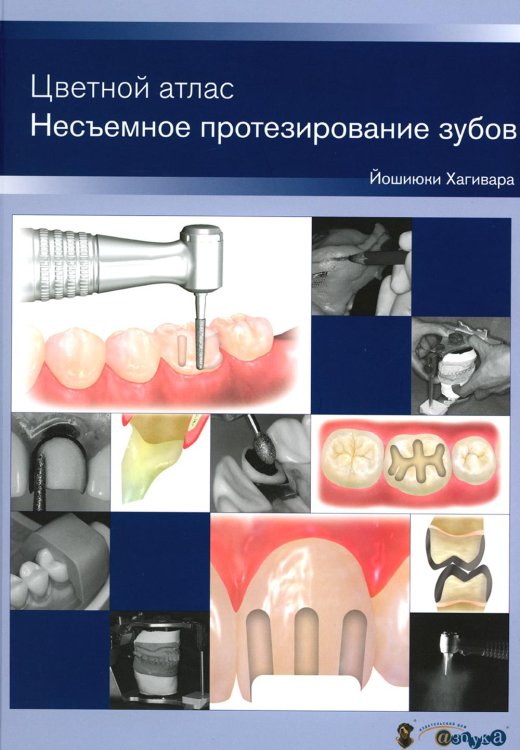 Несъемное протезирование зубов. Цветной атлас Несъемное протезирование зубов. Цветной атлас