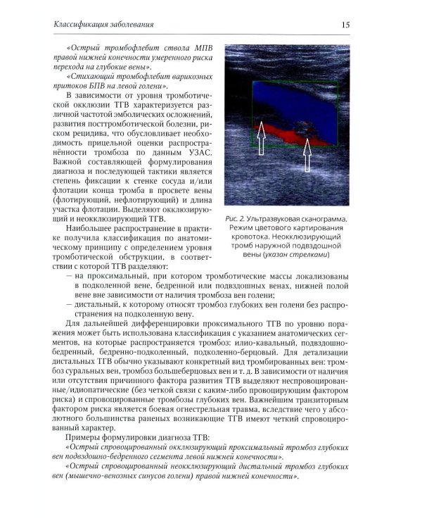 Венозные тромбоэмболические осложнения у раненых: Учебное пособие