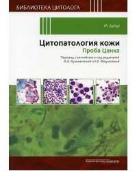 Цитопатология кожи. Проба Цанка