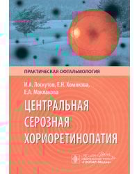 Центральная серозная хориоретинопатия