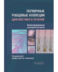 Первичные рубцовые алопеции: диагностика и лечение: иллюстрированное руководство для врачей