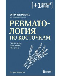 Ревматология по косточкам: симптомы, диагнозы, лечение