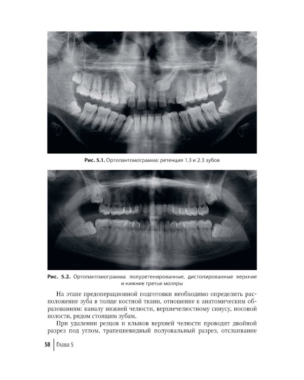 Современные остеопластические материалы: руководство для врачей. 2-е изд., испр. и доп.
