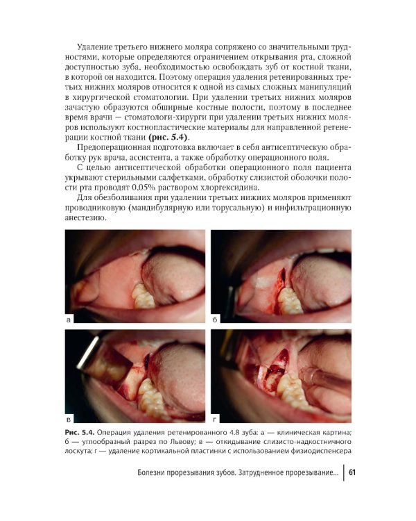 Современные остеопластические материалы: руководство для врачей. 2-е изд., испр. и доп.