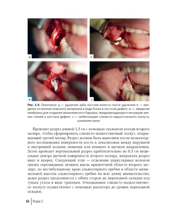 Современные остеопластические материалы: руководство для врачей. 2-е изд., испр. и доп.