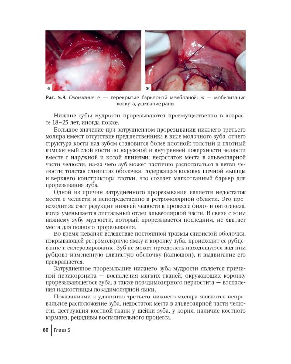 Современные остеопластические материалы: руководство для врачей. 2-е изд., испр. и доп.