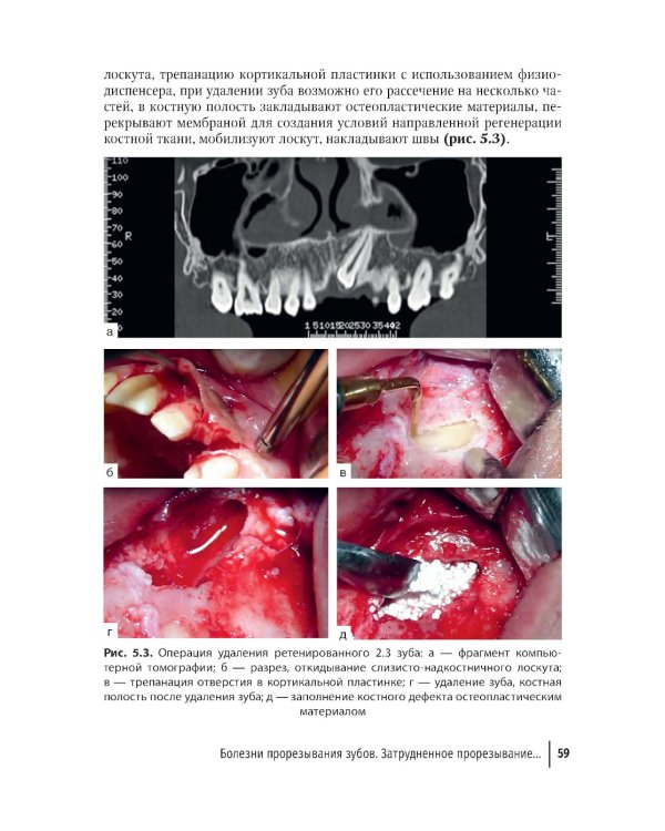 Современные остеопластические материалы: руководство для врачей. 2-е изд., испр. и доп.