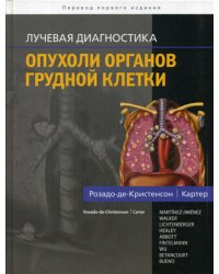 Лучевая диагностика. Опухоли органов грудной клетки
