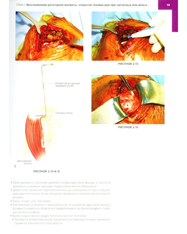 Хирургия плеча и локтя. Оперативная техника. В 2 ч. (комплект из 2 кн.)