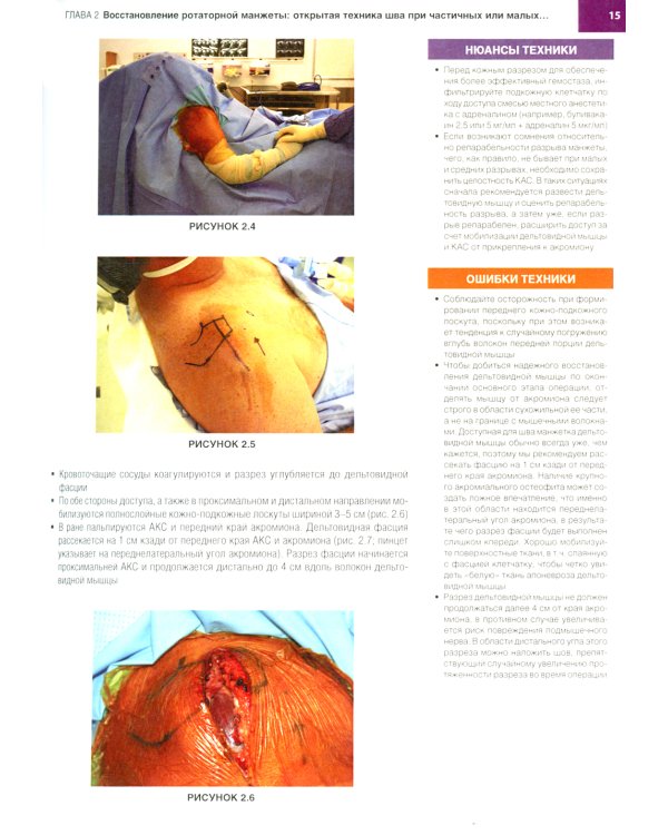 Хирургия плеча и локтя. Оперативная техника. В 2 ч. (комплект из 2 кн.)