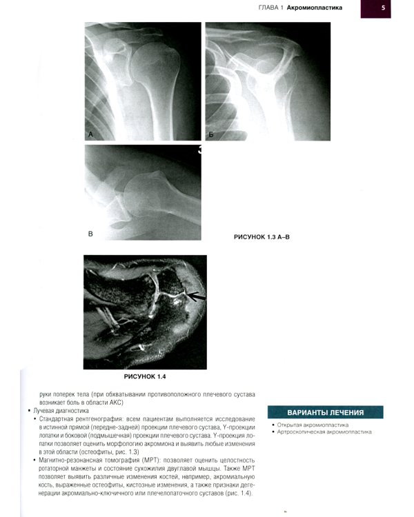 Хирургия плеча и локтя. Оперативная техника. В 2 ч. (комплект из 2 кн.)