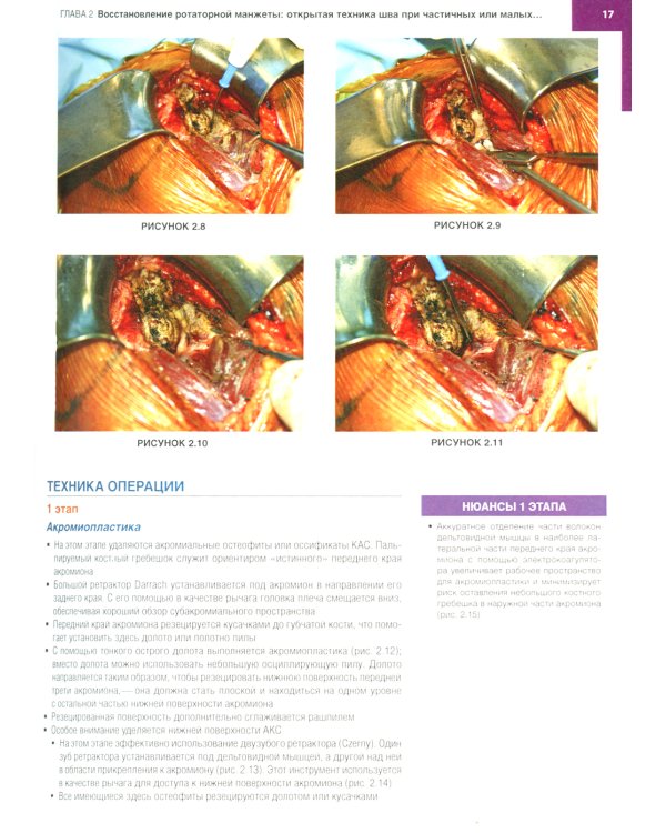 Хирургия плеча и локтя. Оперативная техника. В 2 ч. (комплект из 2 кн.)