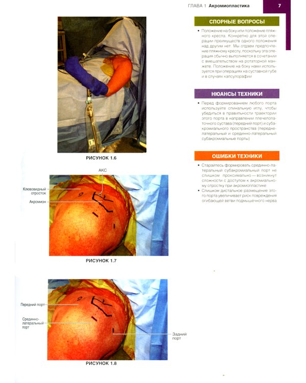 Хирургия плеча и локтя. Оперативная техника. В 2 ч. (комплект из 2 кн.)