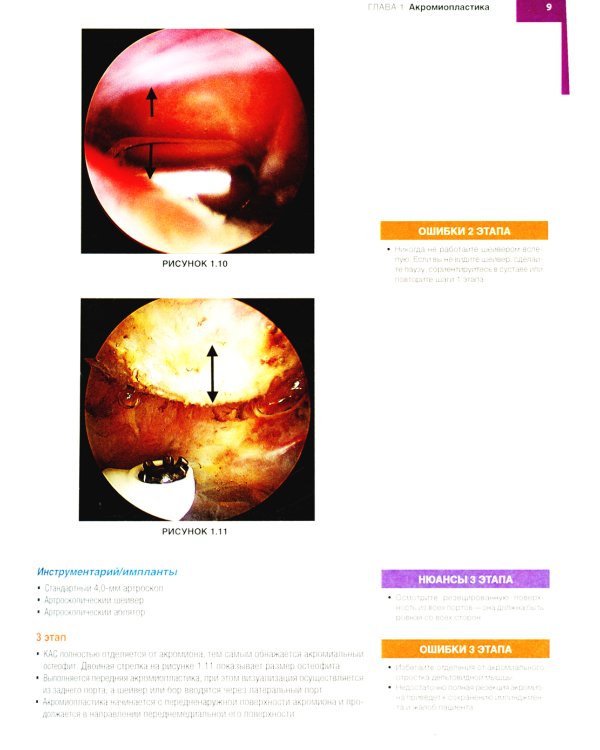 Хирургия плеча и локтя. Оперативная техника. В 2 ч. (комплект из 2 кн.)