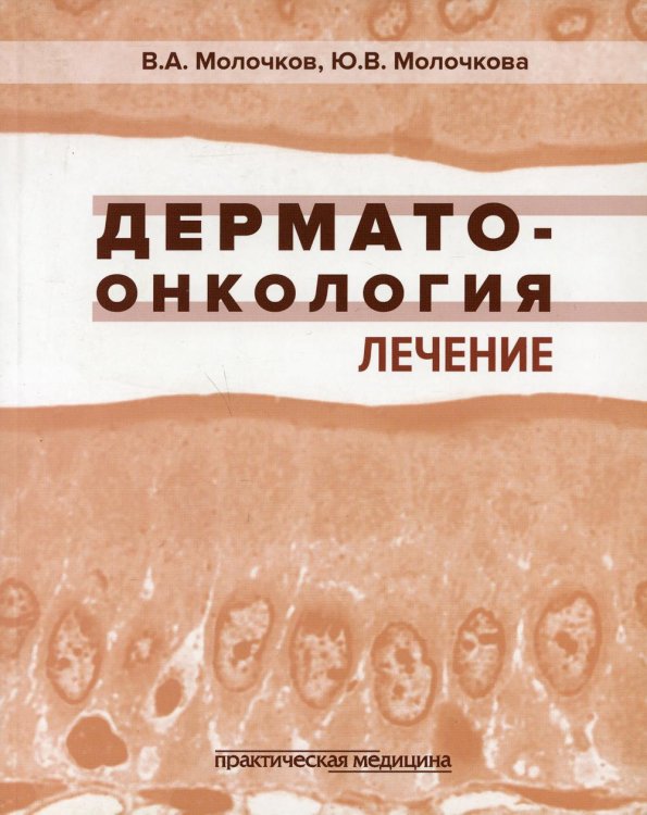 Дерматоонкология. Лечение Дерматоонкология. Лечение