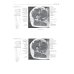 МРТ и КТ. Секционная анатомия МРТ и КТ. Секционная анатомия