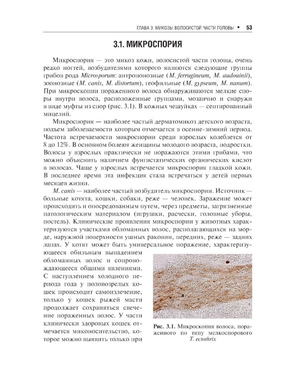 Поверхностные микозы
