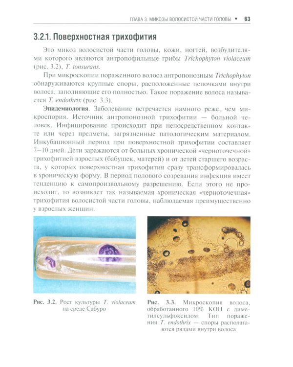 Поверхностные микозы